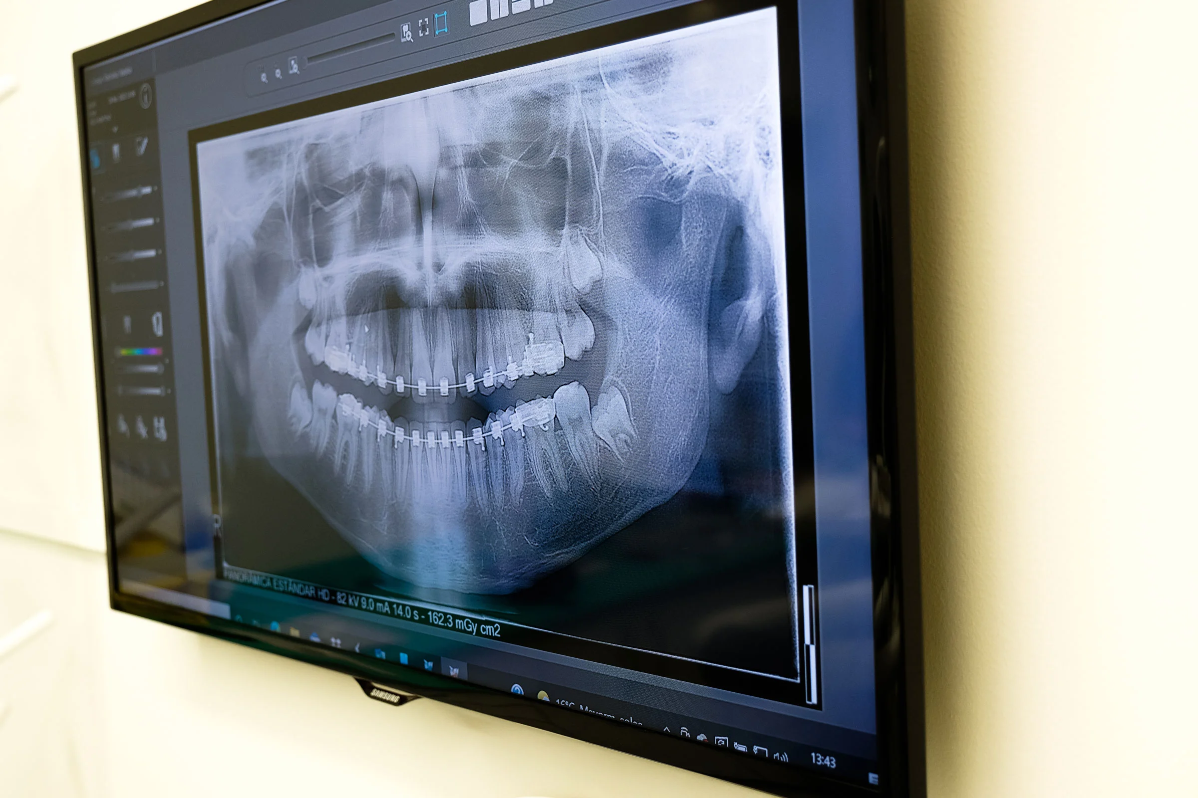 Instalaciones de Clínica Dental Polident en Menasalbas