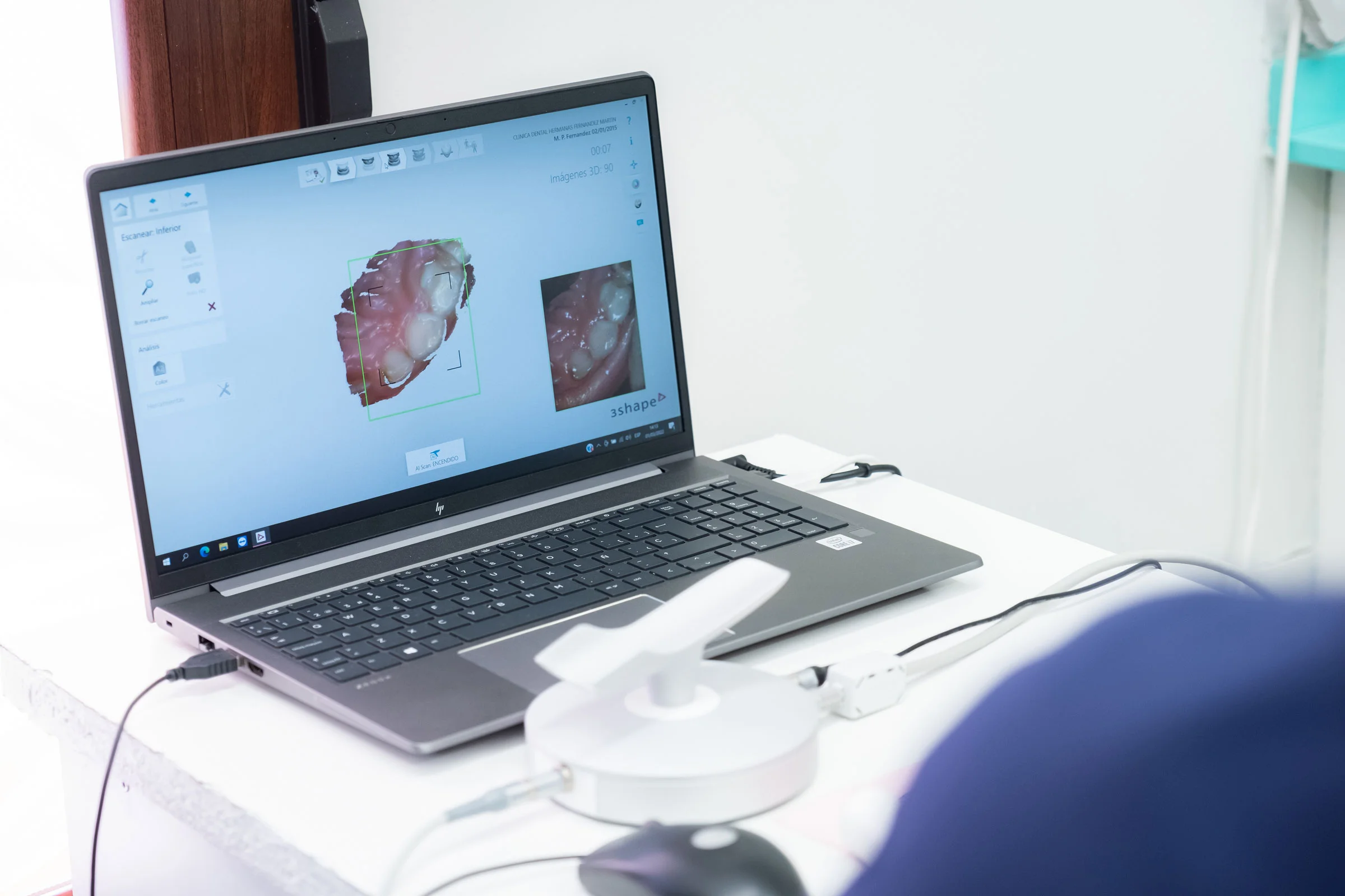 Instalaciones de Clínica Dental Polident en Menasalbas