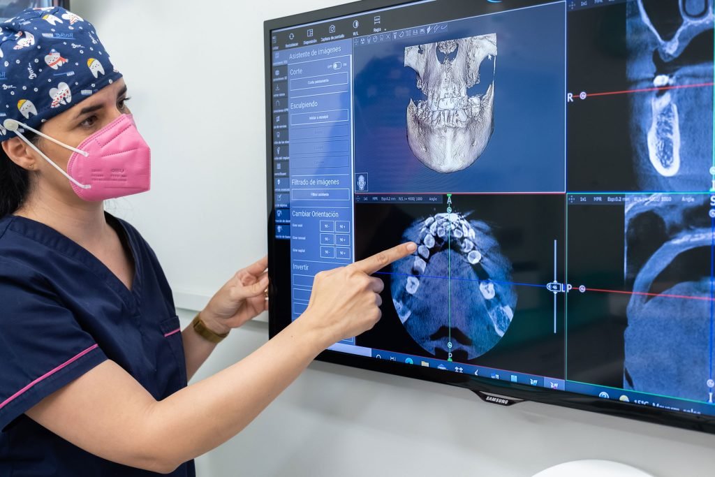 Dentista revisando en la pantalla la planificación 3D de un implante dental en la Clínica Dental Polident de Menasalbas (Toledo)